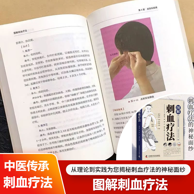 Bloodletting Therapy Explained - Therapy Health And Wellness 评论和价格